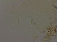Echiniscus becki image