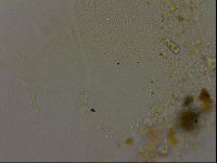 Echiniscus becki image