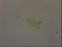 Echiniscus becki image