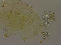 Echiniscus becki image