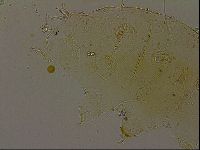Echiniscus becki image