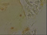 Echiniscus becki image