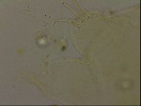 Echiniscus becki image