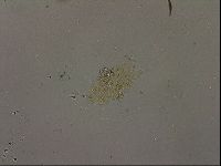 Echiniscus becki image