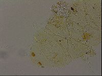 Echiniscus becki image