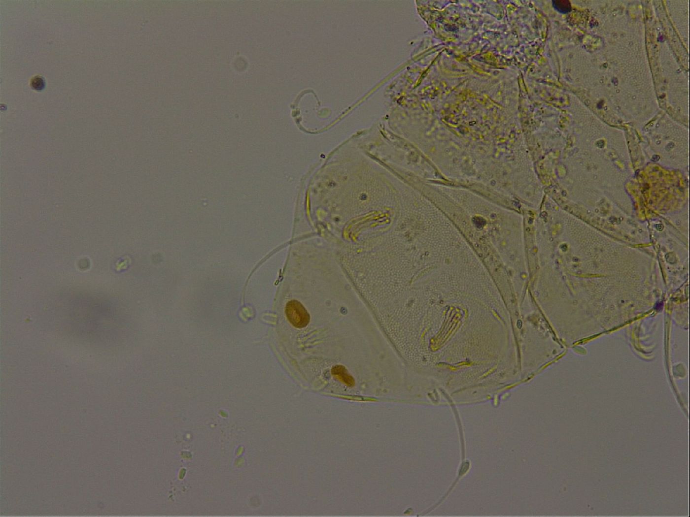 Echiniscus becki image