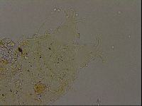Echiniscus becki image