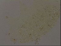 Echiniscus becki image