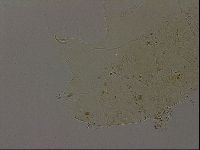 Echiniscus becki image