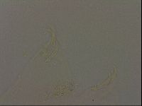 Echiniscus becki image