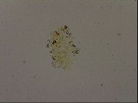 Echiniscus becki image