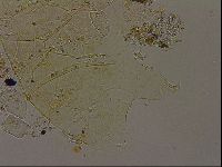 Echiniscus becki image
