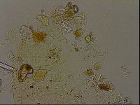 Echiniscus becki image