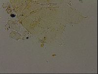 Echiniscus becki image