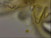 Echiniscus becki image