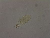 Echiniscus becki image