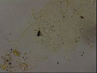 Echiniscus becki image
