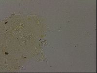 Echiniscus becki image