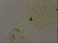 Echiniscus becki image