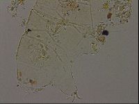 Echiniscus becki image
