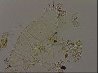 Echiniscus becki image