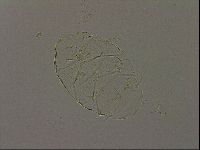 Echiniscus bigranulatus image