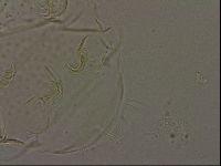 Echiniscus bigranulatus image