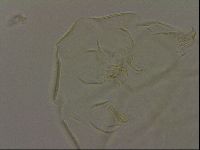 Echiniscus bigranulatus image
