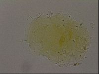 Echiniscus bigranulatus image