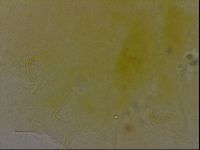 Echiniscus bigranulatus image