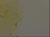 Echiniscus bigranulatus image