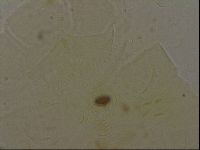 Echiniscus bigranulatus image