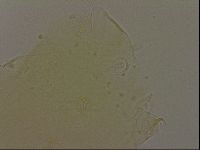 Echiniscus bigranulatus image