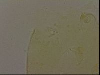 Echiniscus bigranulatus image