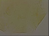 Echiniscus bigranulatus image