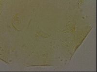 Echiniscus bigranulatus image