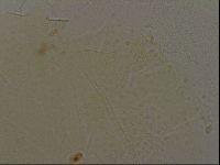 Echiniscus bigranulatus image