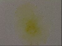 Echiniscus bigranulatus image