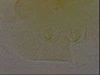 Echiniscus bigranulatus image
