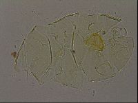 Echiniscus bigranulatus image