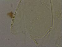 Echiniscus bigranulatus image