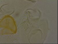 Echiniscus bigranulatus image
