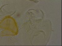 Echiniscus bigranulatus image