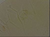 Echiniscus bigranulatus image
