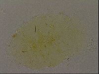 Echiniscus bigranulatus image