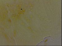 Echiniscus bigranulatus image