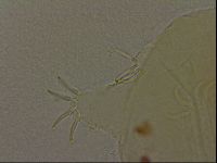 Echiniscus bigranulatus image