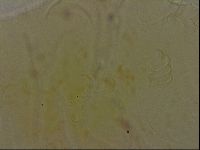 Echiniscus bigranulatus image