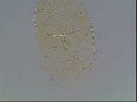 Echiniscus bigranulatus image