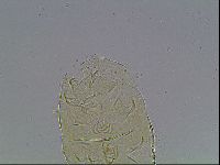 Echiniscus bigranulatus image